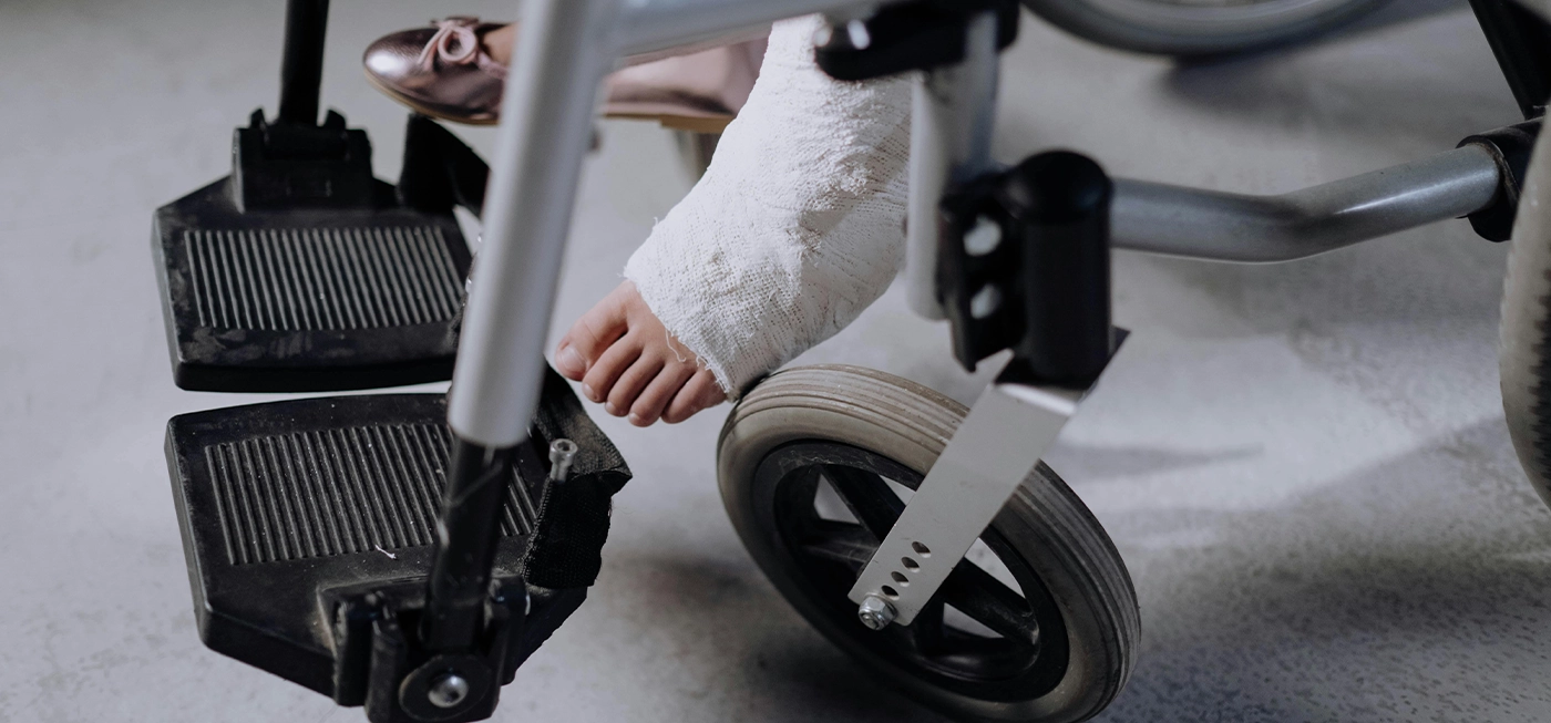 Chine : une colle osseuse révolutionnaire répare les fractures en seulement trois minutes 7 Pied plâtré reposant sur un fauteuil roulant, illustrant une fracture nécessitant immobilisation et potentiellement traitée avec une colle osseuse innovante.